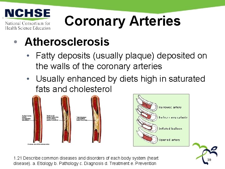 Coronary Arteries • Atherosclerosis • Fatty deposits (usually plaque) deposited on the walls of