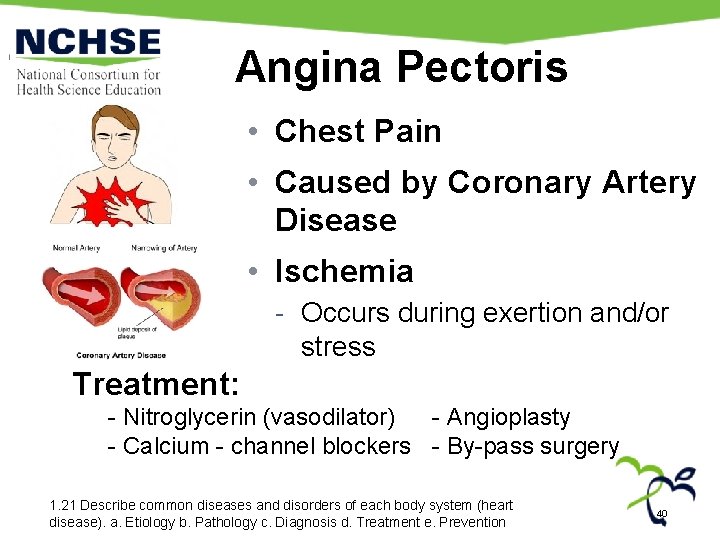 Angina Pectoris • Chest Pain • Caused by Coronary Artery Disease • Ischemia -