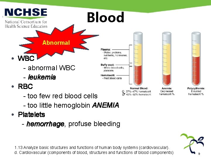 Blood Abnormal • WBC - abnormal WBC - leukemia • RBC - too few