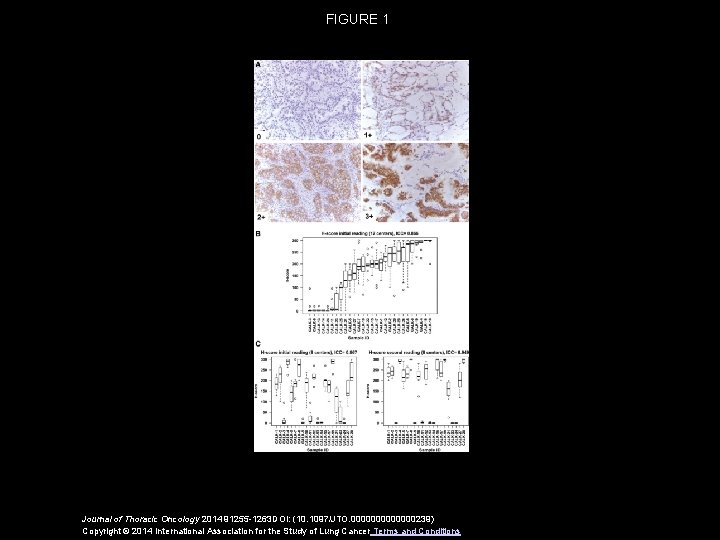 FIGURE 1 Journal of Thoracic Oncology 2014 91255 -1263 DOI: (10. 1097/JTO. 0000000239) Copyright