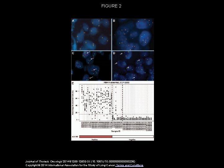 FIGURE 2 Journal of Thoracic Oncology 2014 91255 -1263 DOI: (10. 1097/JTO. 0000000239) Copyright