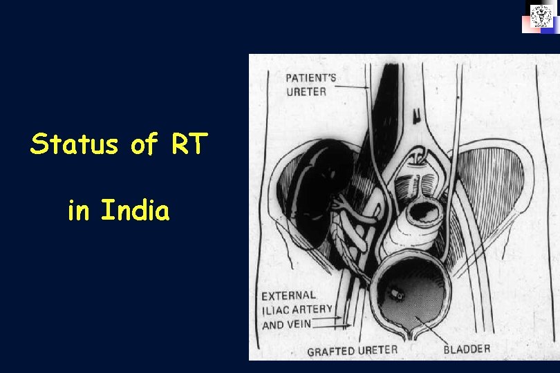 Status of RT in India 