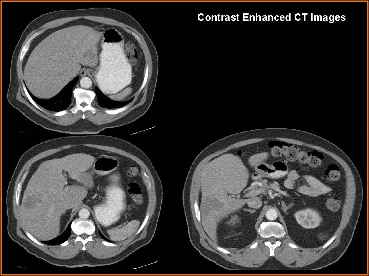 Contrast Enhanced CT Images 