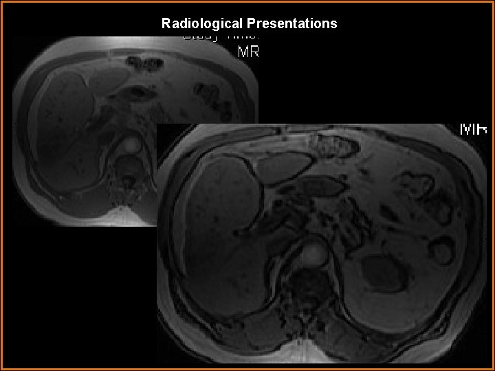 Radiological Presentations 