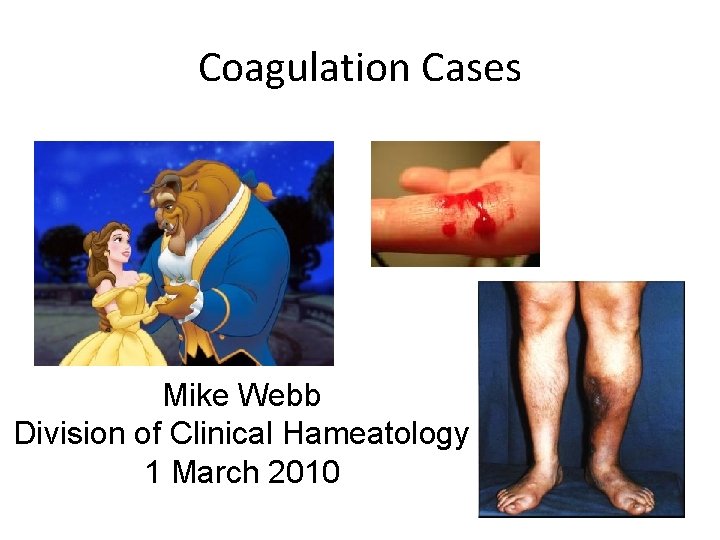 Coagulation Cases Mike Webb Division of Clinical Hameatology 1 March 2010 