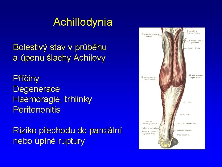 Achillodynia Bolestivý stav v průběhu a úponu šlachy Achilovy Příčiny: Degenerace Haemoragie, trhlinky Peritenonitis
