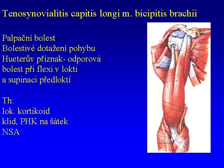 Tenosynovialitis capitis longi m. bicipitis brachii Palpační bolest Bolestivé dotažení pohybu Hueterův příznak- odporová