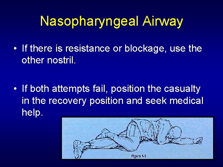 Nasopharyngeal Airway • If there is resistance or blockage, use the other nostril. •