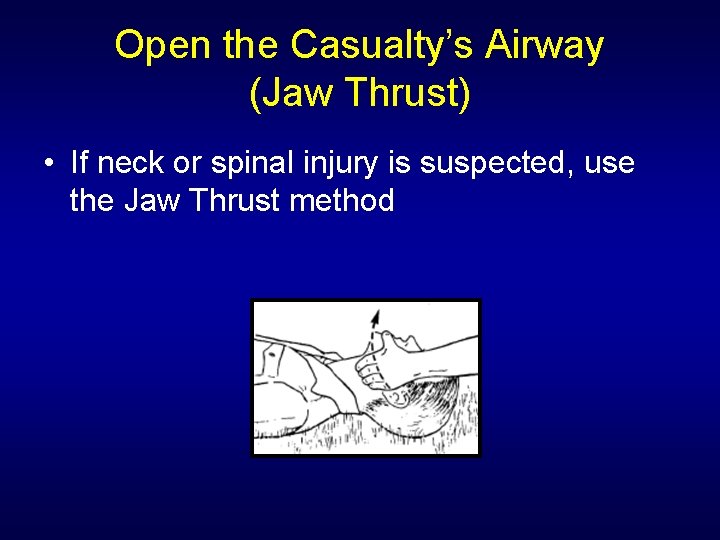 Open the Casualty’s Airway (Jaw Thrust) • If neck or spinal injury is suspected,