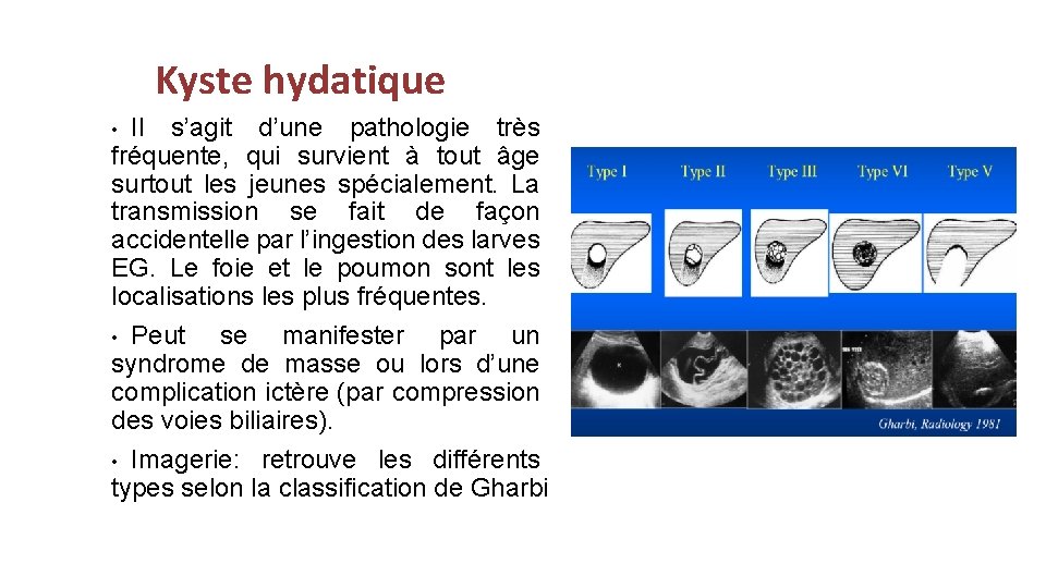 Kyste hydatique Il s’agit d’une pathologie très fréquente, qui survient à tout âge surtout