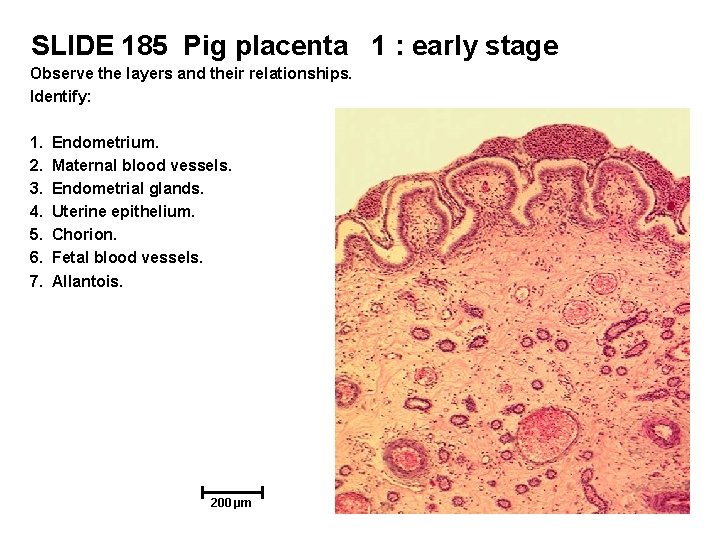 SLIDE 185 Pig placenta 1 : early stage Observe the layers and their relationships.