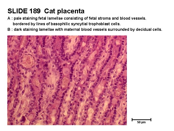 SLIDE 189 Cat placenta A : pale staining fetal lamellae consisting of fetal stroma