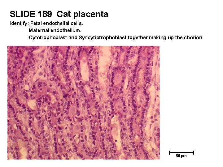 SLIDE 189 Cat placenta Identify: Fetal endothelial cells. Maternal endothelium. Cytotrophoblast and Syncytiotrophoblast together