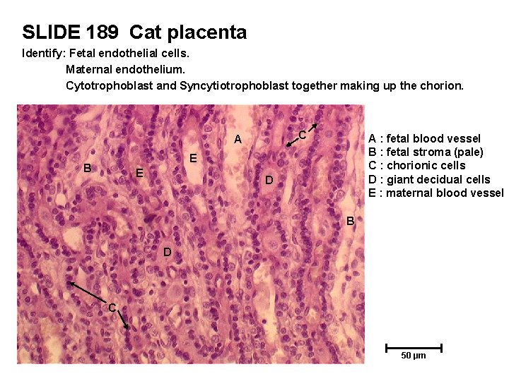 SLIDE 189 Cat placenta Identify: Fetal endothelial cells. Maternal endothelium. Cytotrophoblast and Syncytiotrophoblast together