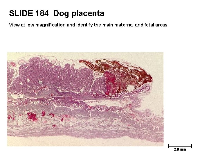 SLIDE 184 Dog placenta View at low magnification and identify the main maternal and