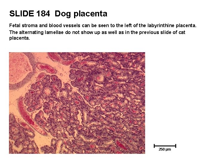 SLIDE 184 Dog placenta Fetal stroma and blood vessels can be seen to the