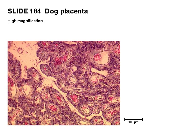 SLIDE 184 Dog placenta High magnification. 100 µm 