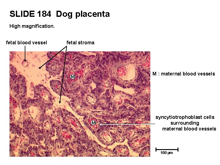 SLIDE 184 Dog placenta High magnification. fetal blood vessel fetal stroma M : maternal