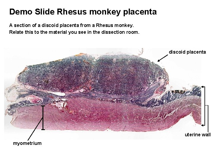 Demo Slide Rhesus monkey placenta A section of a discoid placenta from a Rhesus