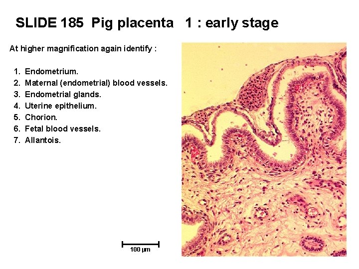 SLIDE 185 Pig placenta 1 : early stage At higher magnification again identify :