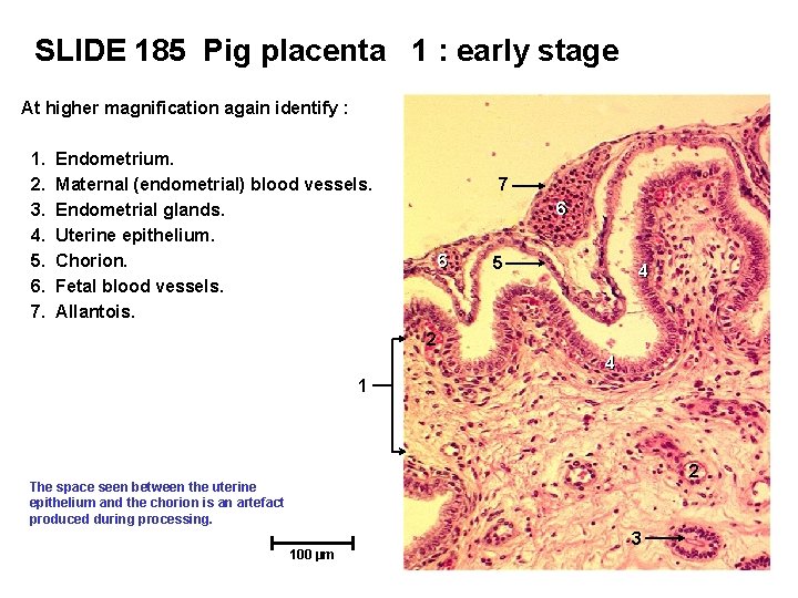 SLIDE 185 Pig placenta 1 : early stage At higher magnification again identify :