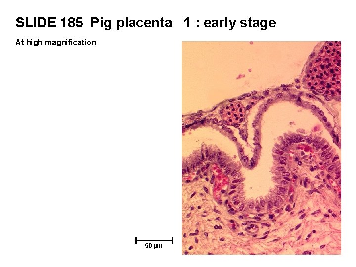 SLIDE 185 Pig placenta 1 : early stage At high magnification 50 µm 