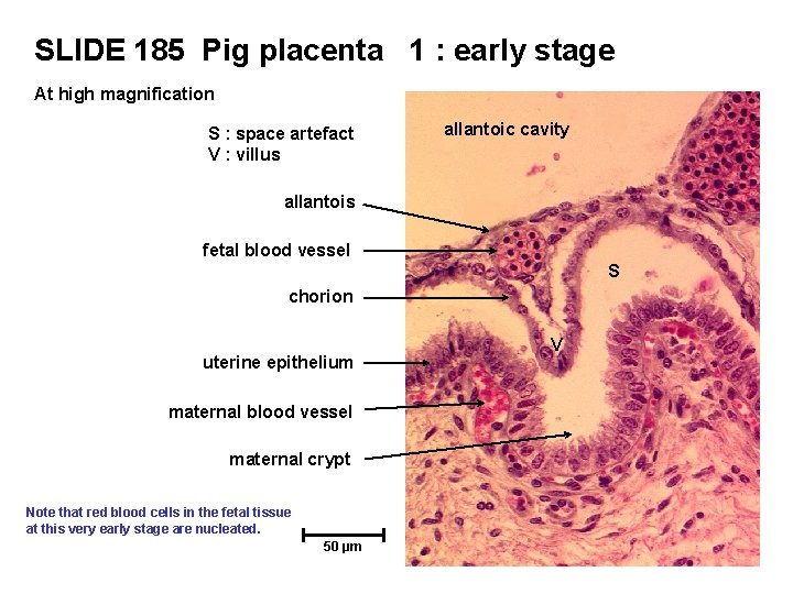 SLIDE 185 Pig placenta 1 : early stage At high magnification S : space