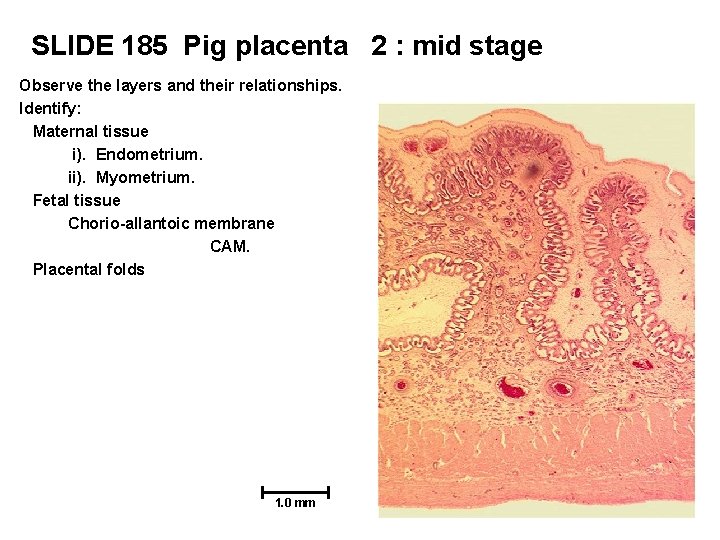 SLIDE 185 Pig placenta 2 : mid stage Observe the layers and their relationships.