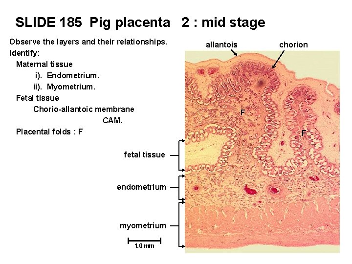 SLIDE 185 Pig placenta 2 : mid stage Observe the layers and their relationships.