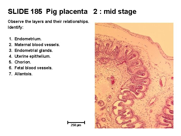 SLIDE 185 Pig placenta 2 : mid stage Observe the layers and their relationships.