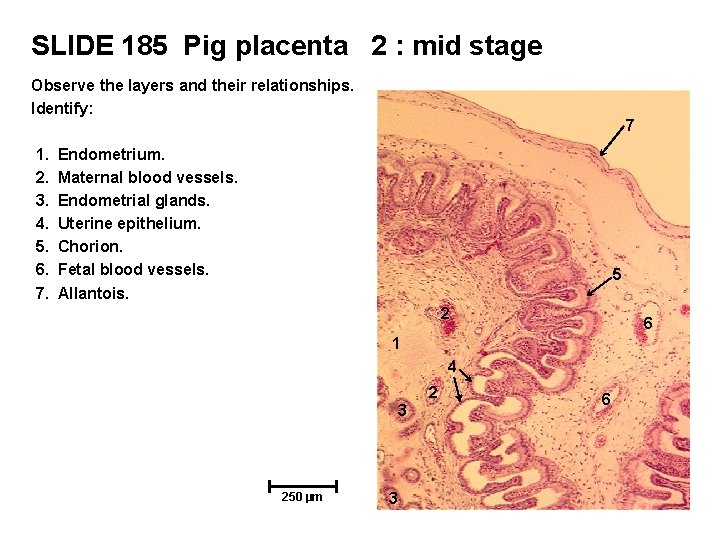 SLIDE 185 Pig placenta 2 : mid stage Observe the layers and their relationships.