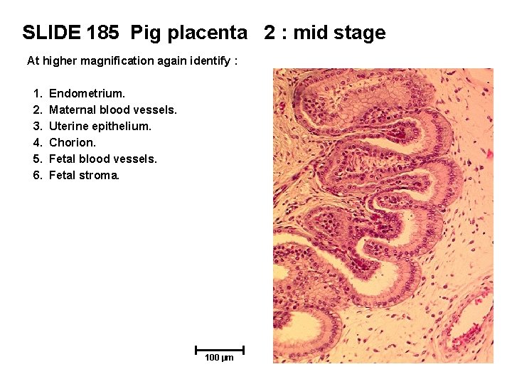 SLIDE 185 Pig placenta 2 : mid stage At higher magnification again identify :