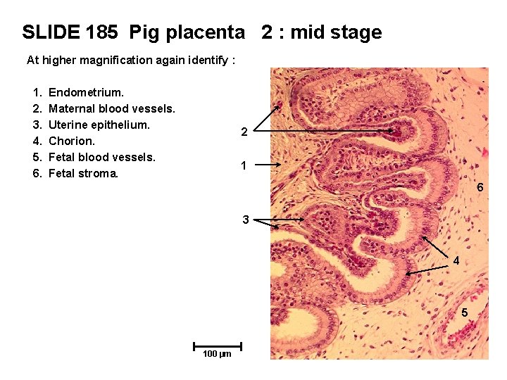 SLIDE 185 Pig placenta 2 : mid stage At higher magnification again identify :