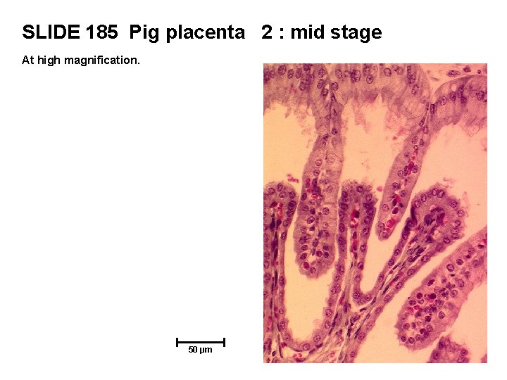 SLIDE 185 Pig placenta 2 : mid stage At high magnification. 50 µm 