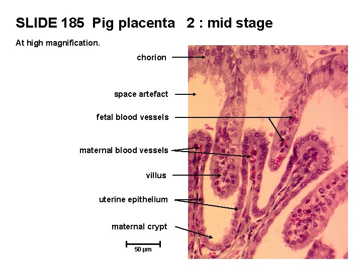 SLIDE 185 Pig placenta 2 : mid stage At high magnification. chorion space artefact