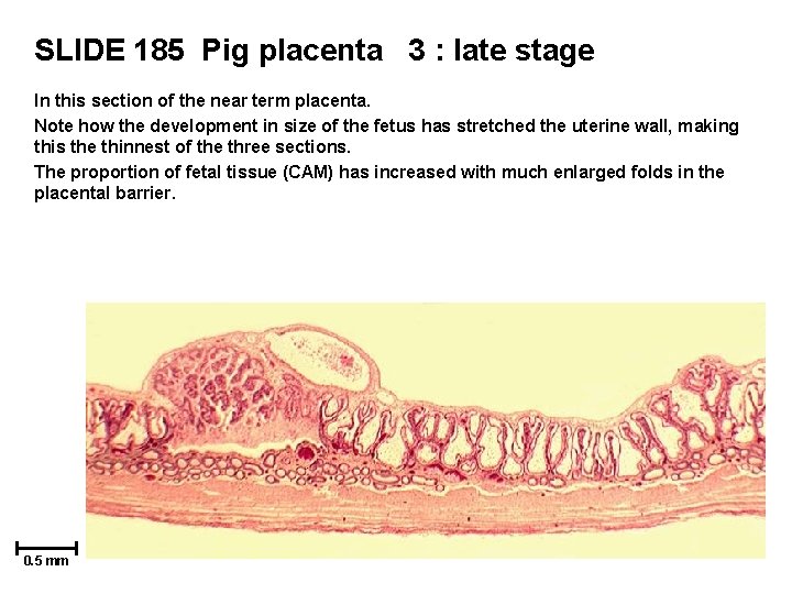 SLIDE 185 Pig placenta 3 : late stage In this section of the near