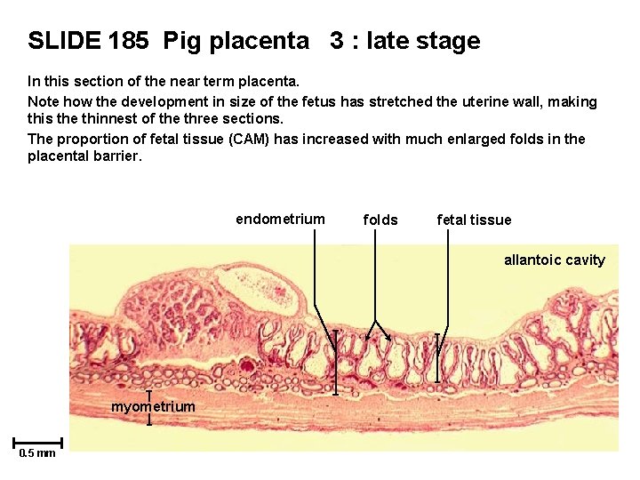 SLIDE 185 Pig placenta 3 : late stage In this section of the near