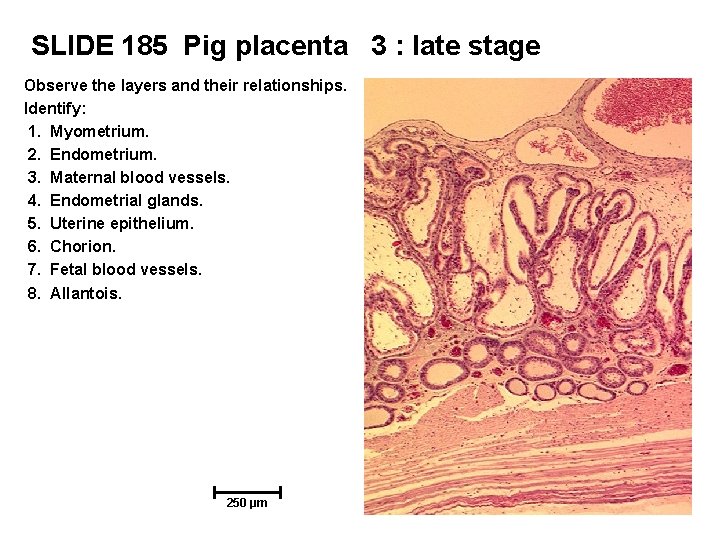 SLIDE 185 Pig placenta 3 : late stage Observe the layers and their relationships.