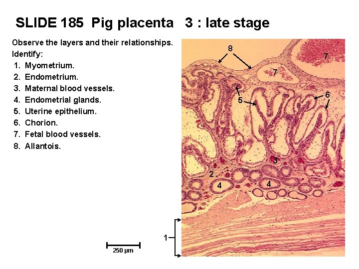 SLIDE 185 Pig placenta 3 : late stage Observe the layers and their relationships.