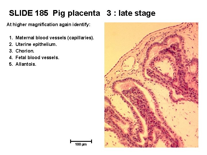 SLIDE 185 Pig placenta 3 : late stage At higher magnification again identify: 1.