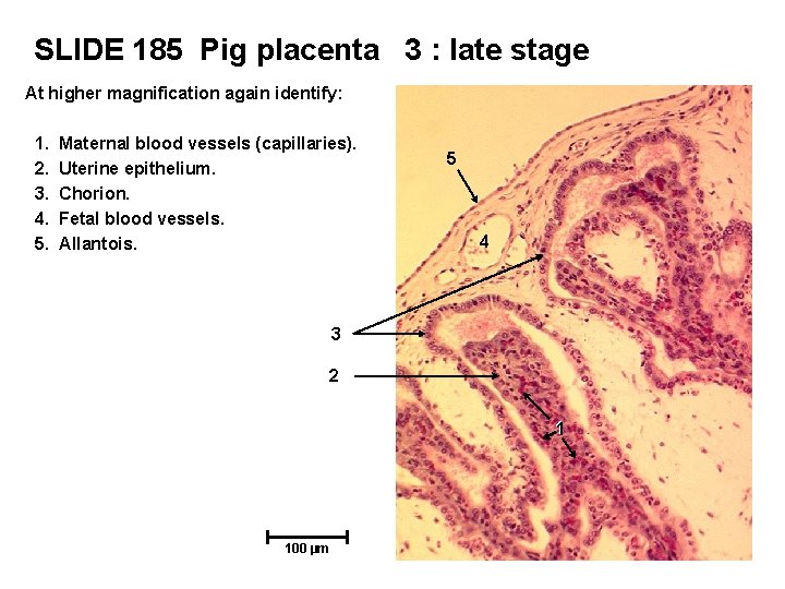 SLIDE 185 Pig placenta 3 : late stage At higher magnification again identify: 1.