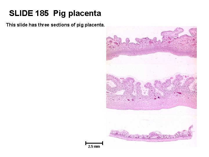 SLIDE 185 Pig placenta This slide has three sections of pig placenta. 2. 5