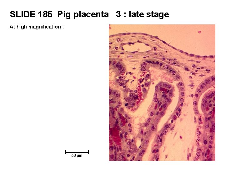 SLIDE 185 Pig placenta 3 : late stage At high magnification : 50 µm