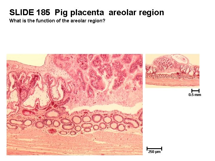 SLIDE 185 Pig placenta areolar region What is the function of the areolar region?