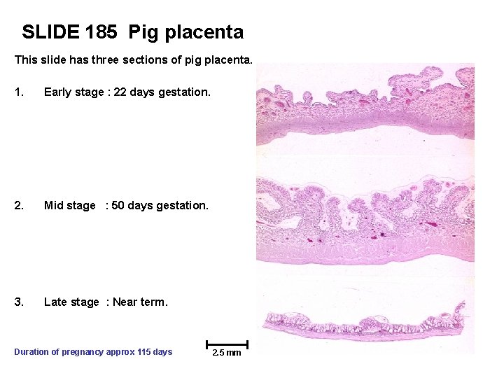 SLIDE 185 Pig placenta This slide has three sections of pig placenta. 1. Early