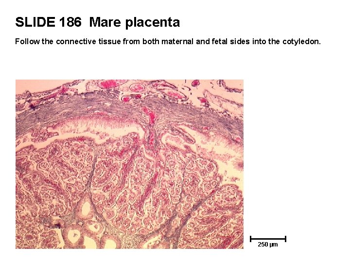 SLIDE 186 Mare placenta Follow the connective tissue from both maternal and fetal sides