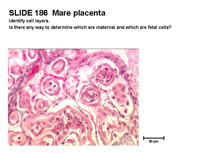 SLIDE 186 Mare placenta Identify cell layers. Is there any way to determine which