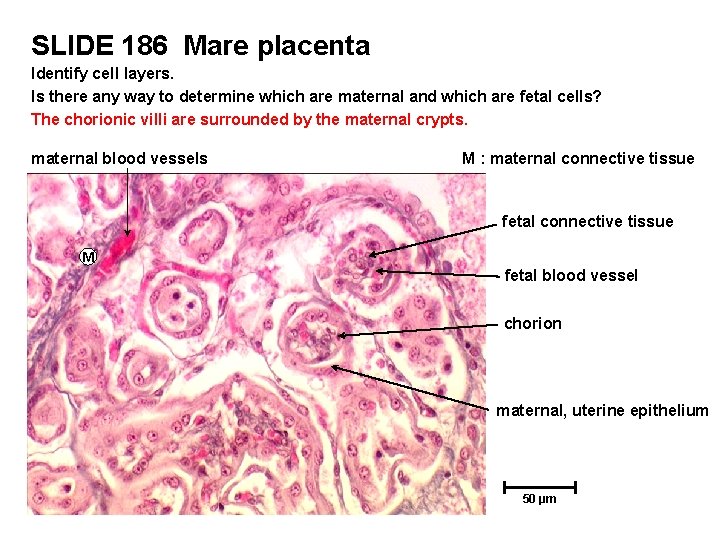 SLIDE 186 Mare placenta Identify cell layers. Is there any way to determine which