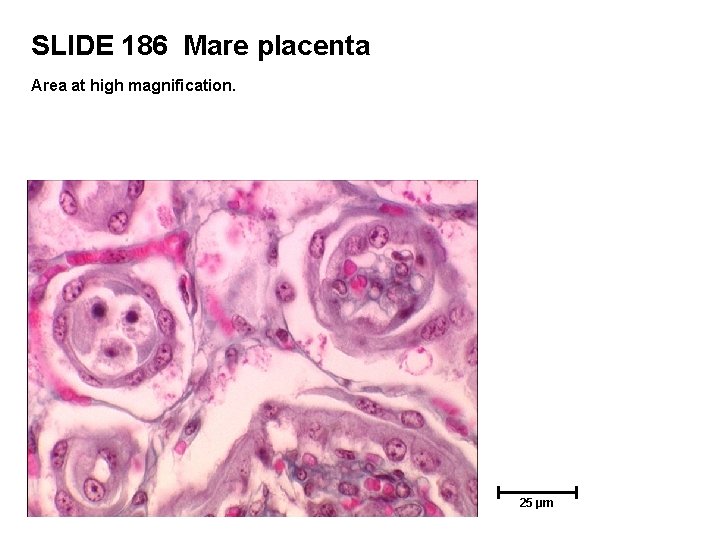 SLIDE 186 Mare placenta Area at high magnification. 25 µm 