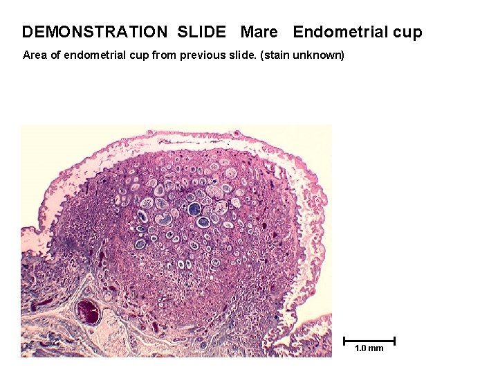 DEMONSTRATION SLIDE Mare Endometrial cup Area of endometrial cup from previous slide. (stain unknown)